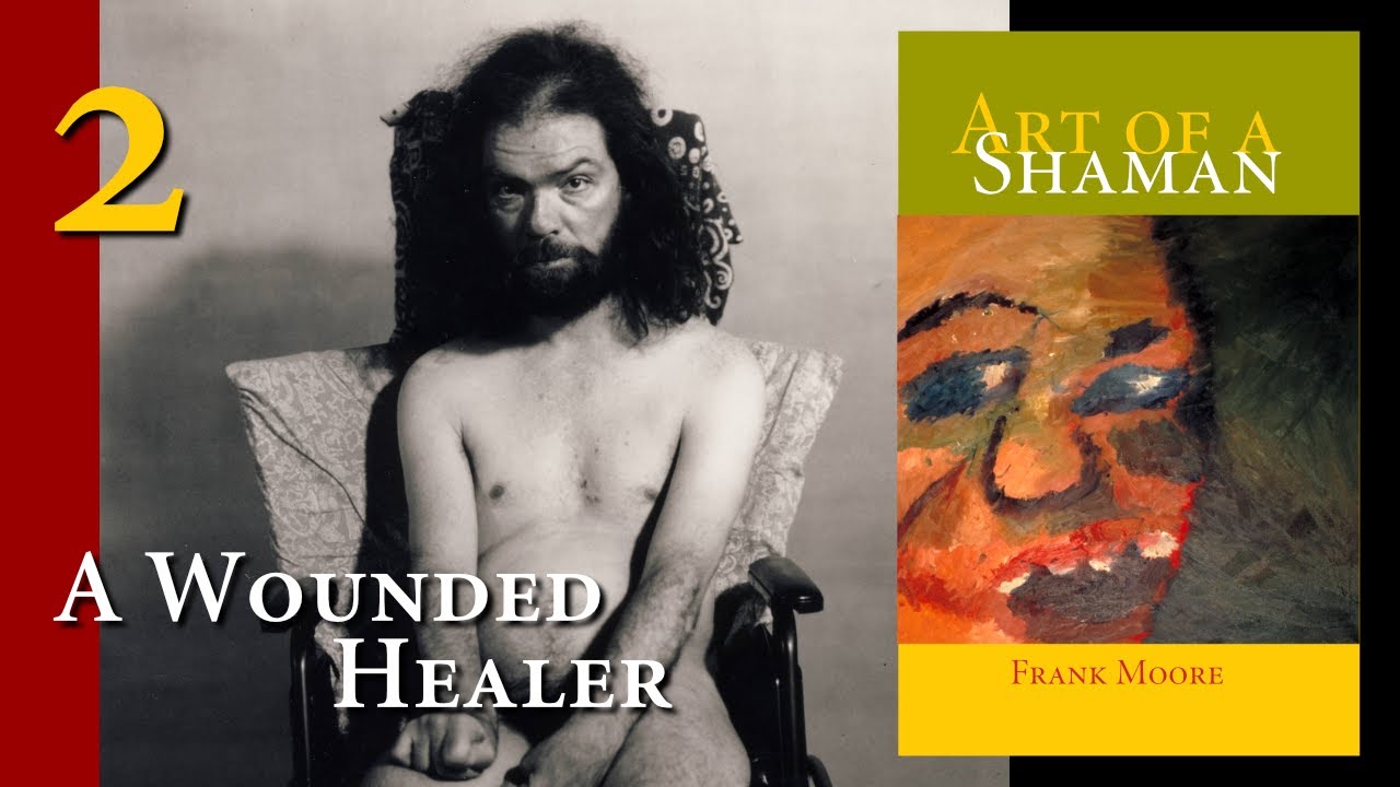 Episode 2 – A Wounded Healer – Let Me Be Frank
