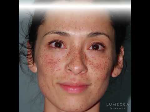 Video library showcasing dermatology treatments and skincare education.