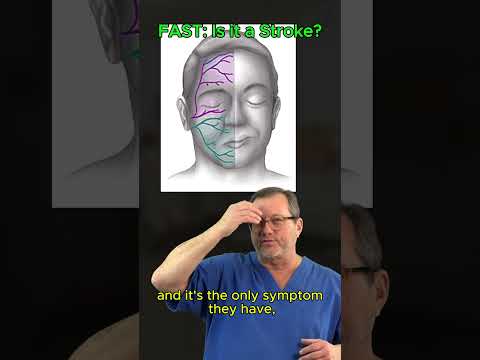 Can YOU Spot a Stroke? (FAST Test)