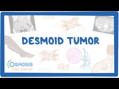 Desmoid Tumor NORD