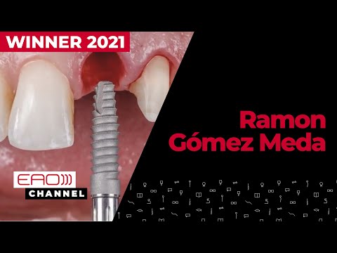Immediate implant loading & simultaneous hard and soft tissues reconstruction
