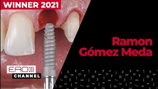 Immediate implant loading &amp; simultaneous hard and soft tissues reconstruction w/ Ramon Gómez Meda
