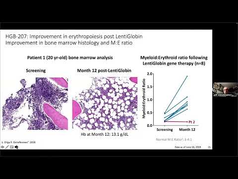 Gene Therapy in Hemoglobinopathies – Dr. Emanuele Angelucci (May 26-27, 2023)