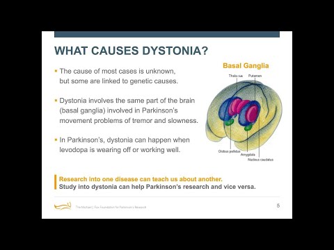 neurocirkulációs dystonia hipertóniával