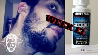 Minoxidil Beard | Week 13 | 3 Months! | The Experiment |  #FacialFuzzFridays