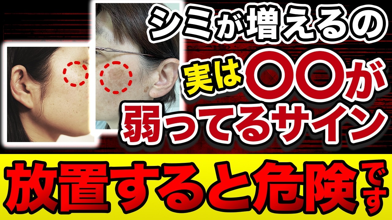 足首がむくんでる人、将来シミまみれになります