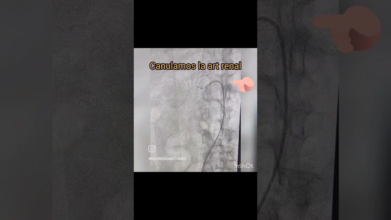 Jorge Alvarez Gutierrez-10