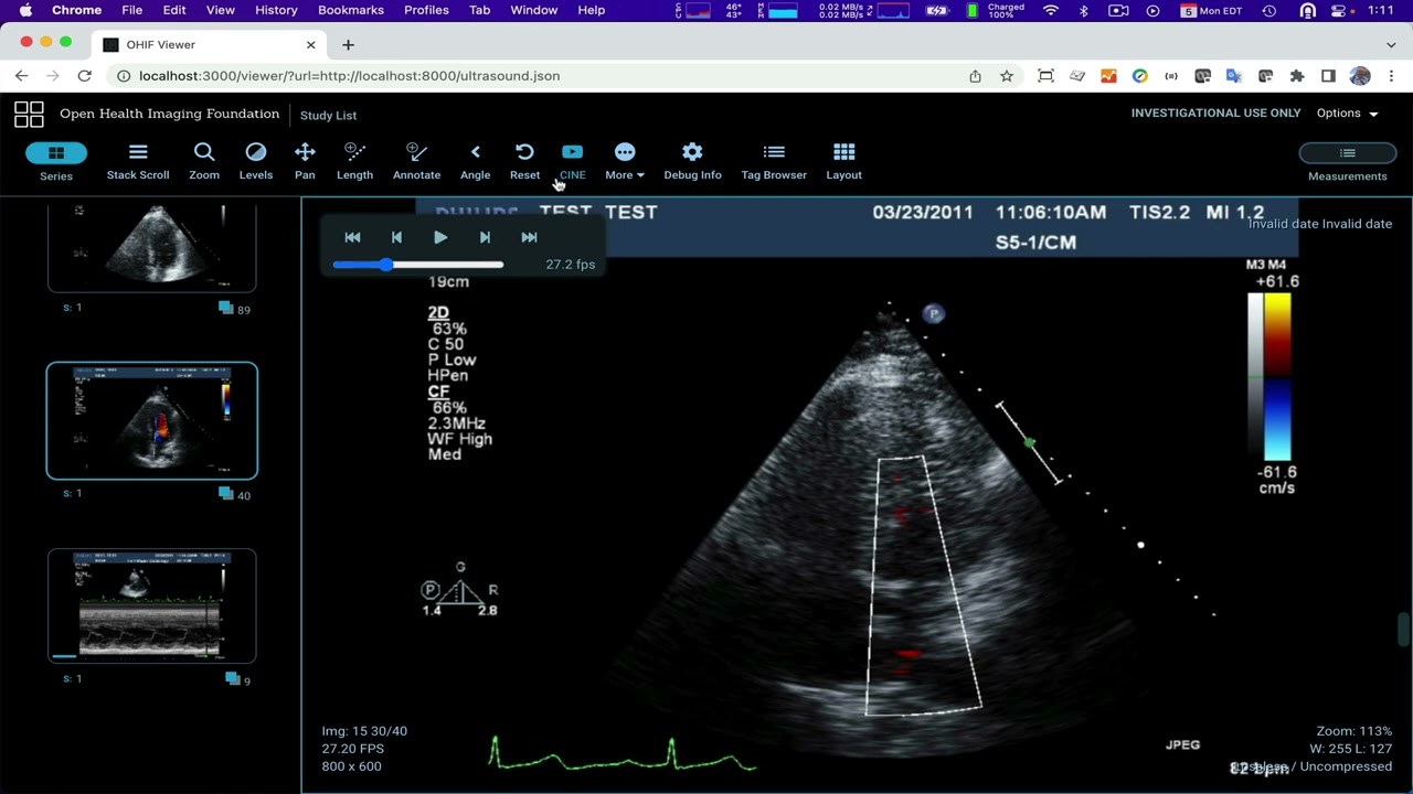 OHIF multiframe autoplay