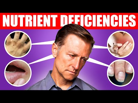 The Number One Best Exercise for Depression