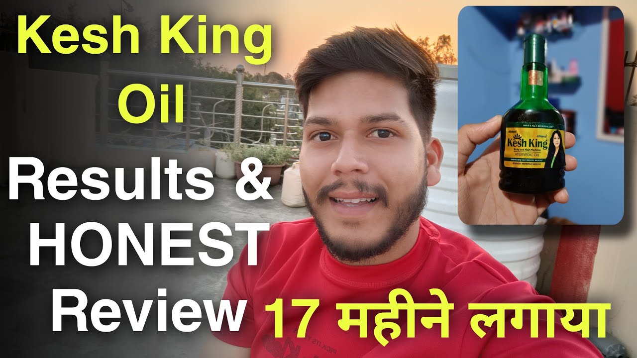 Kesh King Hair Oil HONESTY Review 2022 In Hindi | Kesh King Hair Oil Results, Benefits Uses Price