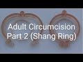 Adult Circumcision Story Shang Ring Part 2