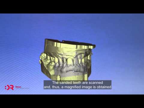 Zobotehnični laboratorij | Dental laboratory | Zubotehnički laboratorij | Zagreb | Štimac centar dentalne medicine | Zubotehnički laboratorij Stomatološka poliklinika Zagreb | Štimac centar dentalne medicine