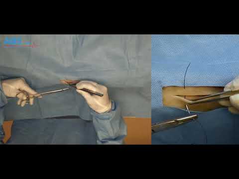 Blair donati - Tutoriel ABS Lab