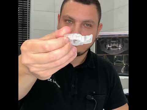 Watch the video