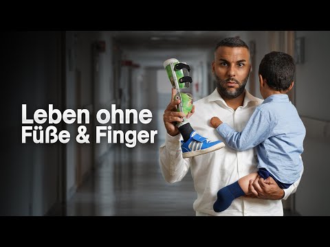 My son had to have four amputations | Our life after sepsis