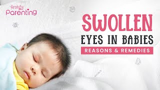 Swollen Eyes in Babies - Causes and Remedies