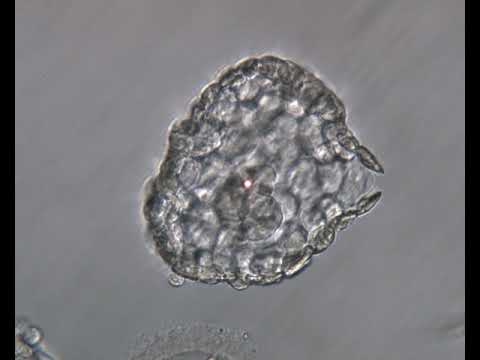 Frozen Embryo Transfer (FET)