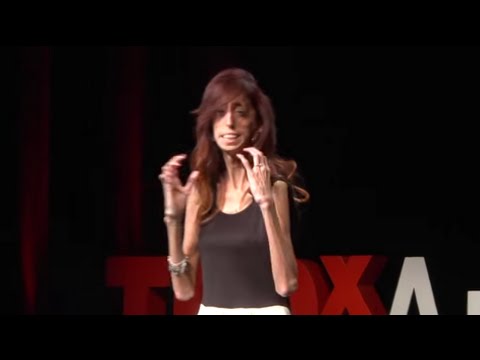 How do you define yourself? | Lizzie Velasquez | TEDxAustinWomen
