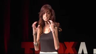 How do you define yourself? | Lizzie Velasquez | TEDxAustinWomen