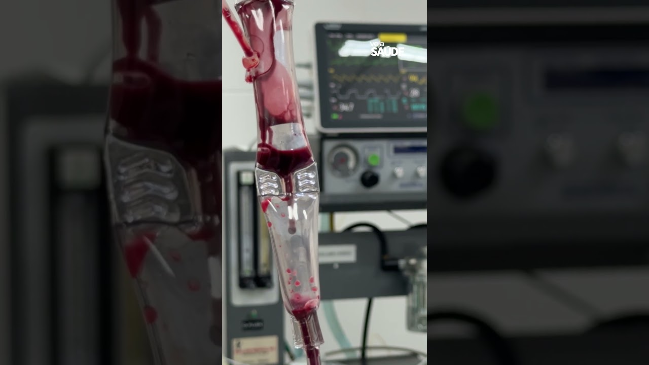 Onça-pintada também doa sangue; assista ao vídeo de procedimento inédito no Brasil