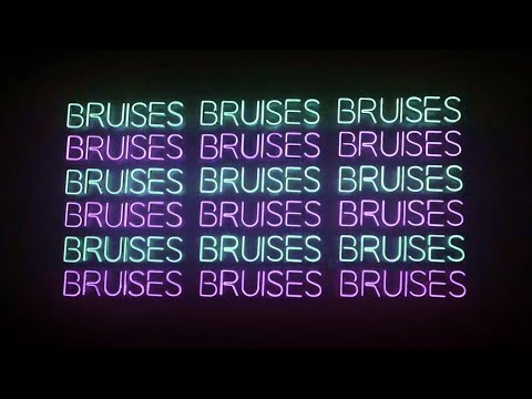 IZKO, MOLOW - Bruises (Lyrics) ft. Jay Mason