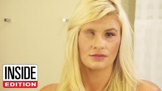 Mom Who Went Blind When She Was Shot in Las Vegas Massacre Can See Again