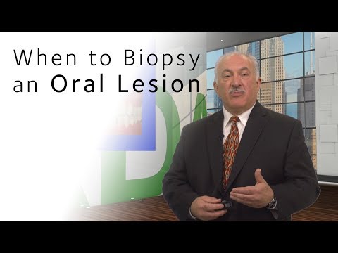image-What is a dental lesion?