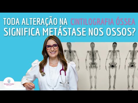Toda alteração na cintilografia óssea significa metástase nos ossos?