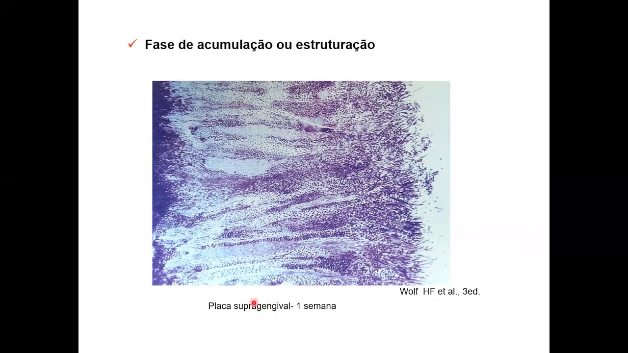 Microbiologia da Doença Periodontal - parte 1