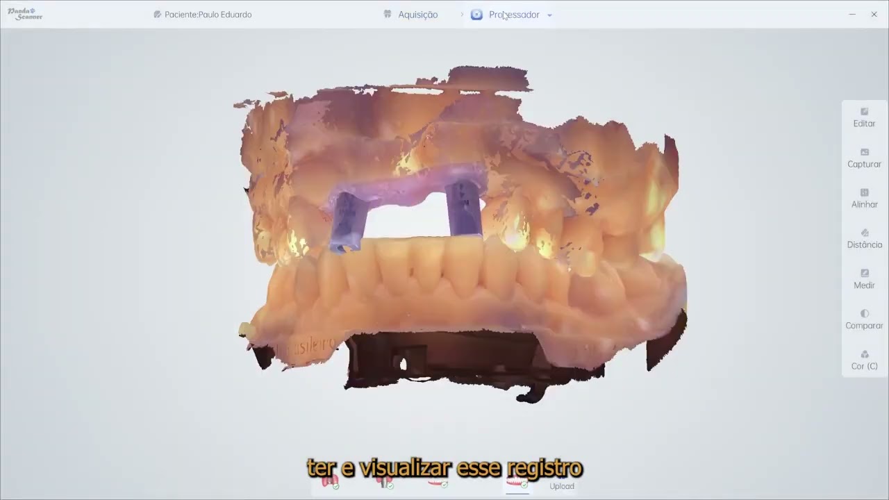 Vídeo 21 - Oclusão Dinâmica