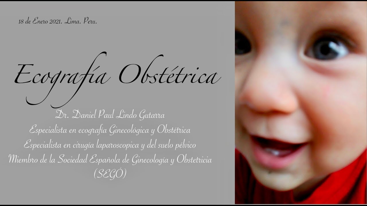 Daniel Paul Lindo Gutarra-23