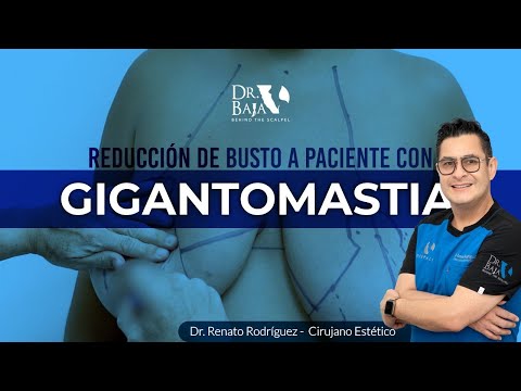 Renato Rodríguez Hirales-56