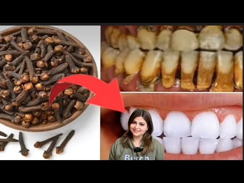 Teeth whitening at home|how to clean teeth at home yellow your white|bad breath treatment at home