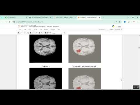 Brain Tumor Detection 2d 3d Image Classification in Python Projects