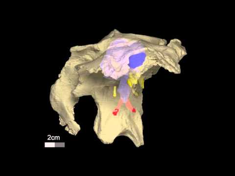 Titanosaurian sauropod braincase & brain endocast from the Cretaceous of Spain