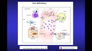Anemias ferropénicas