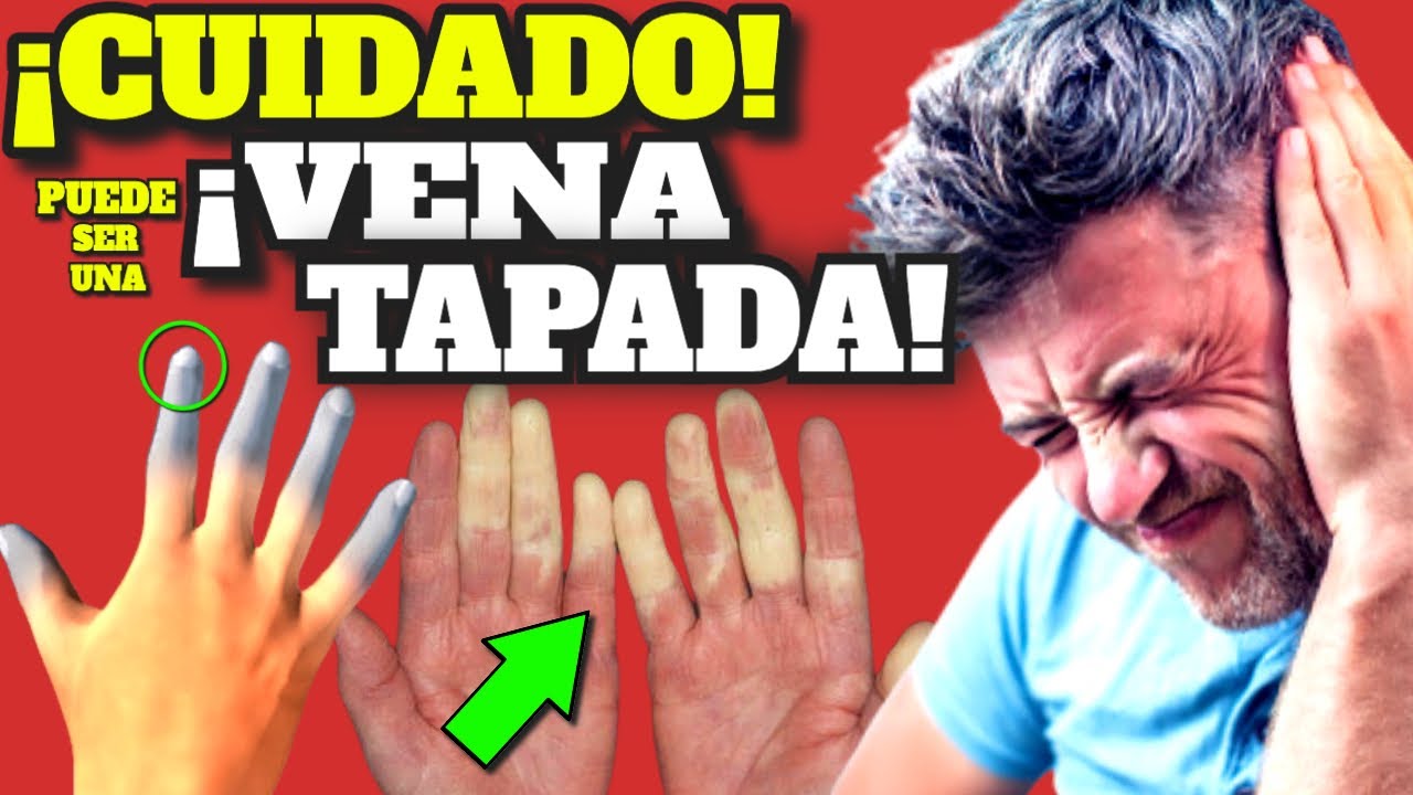 ¡ATENCION! ESTOS SINTOMAS INDICAN que TENES VASOS SANGUIENOS TAPADOS| VENAS TAPADAS