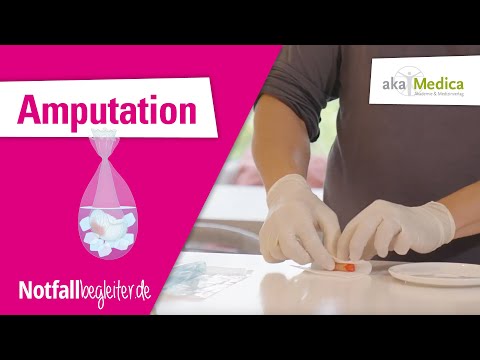Amputation   Erste Hilfe bei Babys und Kindern – Notfallbegleiter 25
