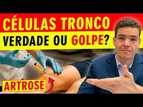 Stem cells for osteoarthritis: do they really work or are they a scam?