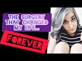 A bad surgery experience (why I chose thyroid RFA)