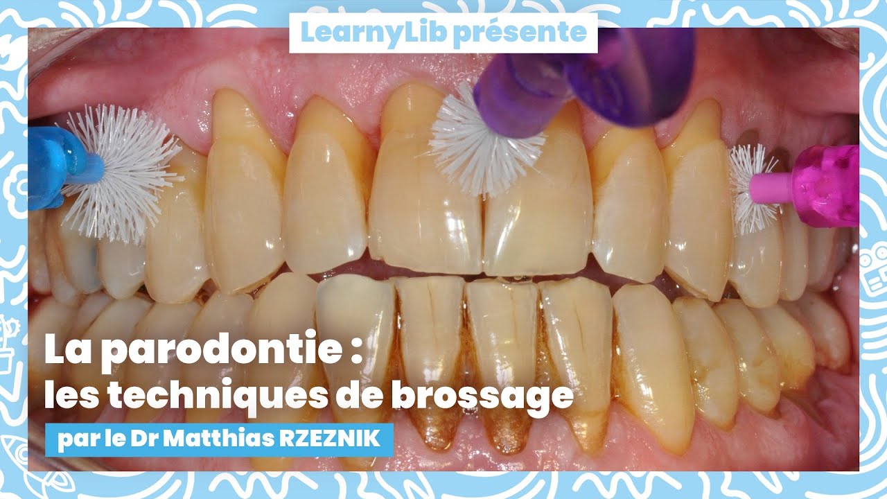 🦷 La parodontie : les différentes techniques de brossage avec le Dr Matthias RZEZNIK