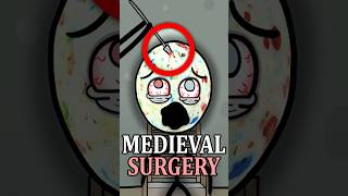 Medieval Surgery Was Terrifying 🦴😵‍💫 #didyouknow #medieval #facts #history
