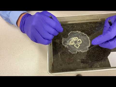 Jellyfish anatomy - the moon jelly,  Aurelia