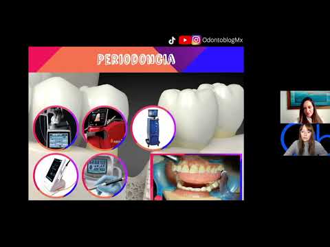 Uso de Láser en PERIODONCIA