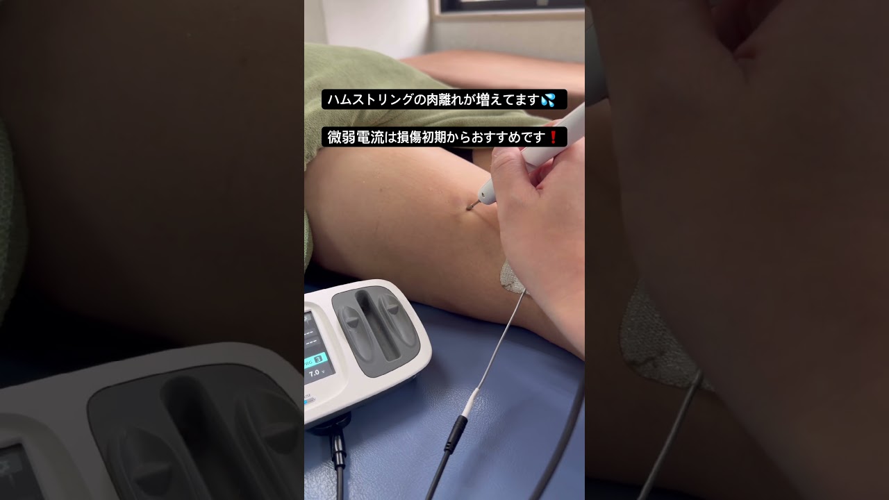 ハムストリングの肉離れに微弱電流（IM-2000）おすすめです❗️