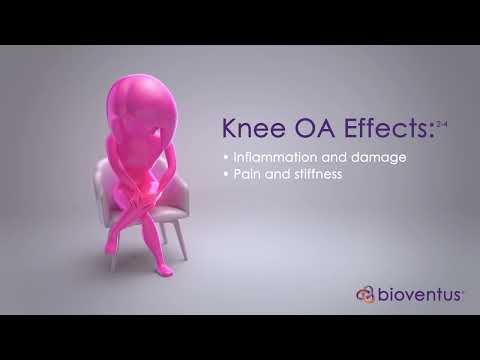 Sovisc 32mg hyaluronic acid injection, 2ml