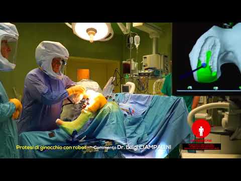 Degenerazione muscolare della colonna cervicale Olio essenziale di articolazioni delle gambe