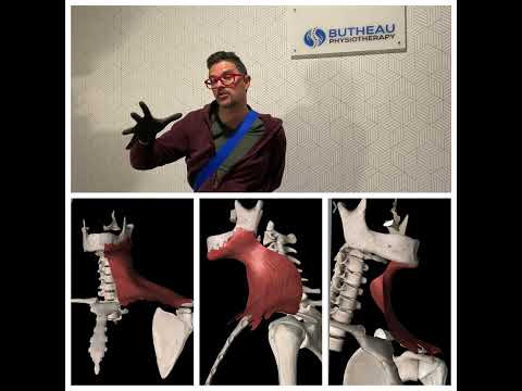 Addressing Neck Tension With Bell’s Palsy