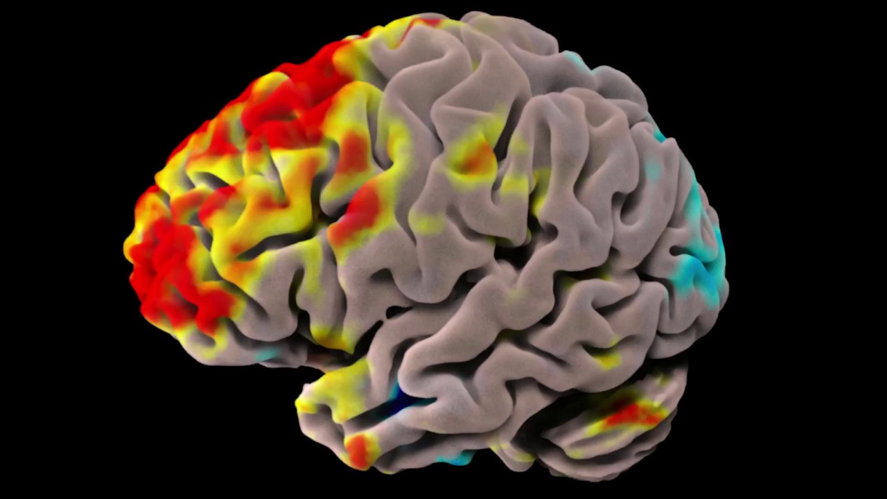fMRI Data Visualization