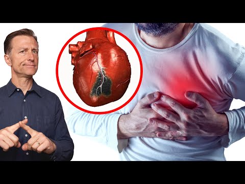 The #1 Best Remedy to Prevent a Heart Attack for $3.19